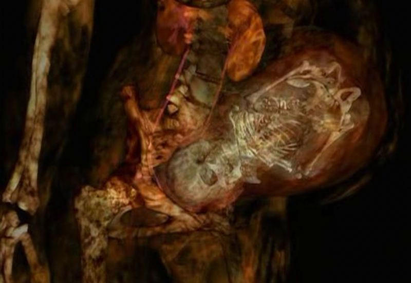 BBC: ��������� ������� �������� (3 DVD)